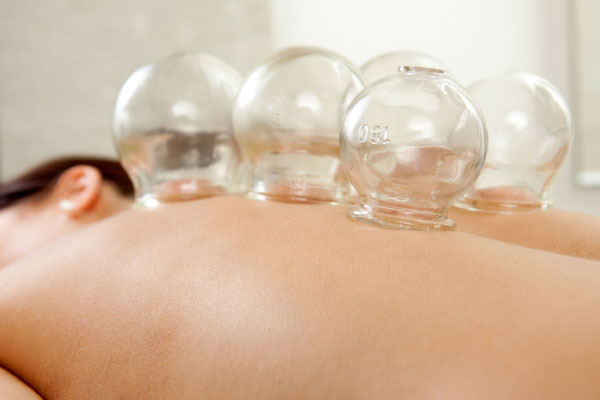 Need a detox? Visit The Cupping Therapy!